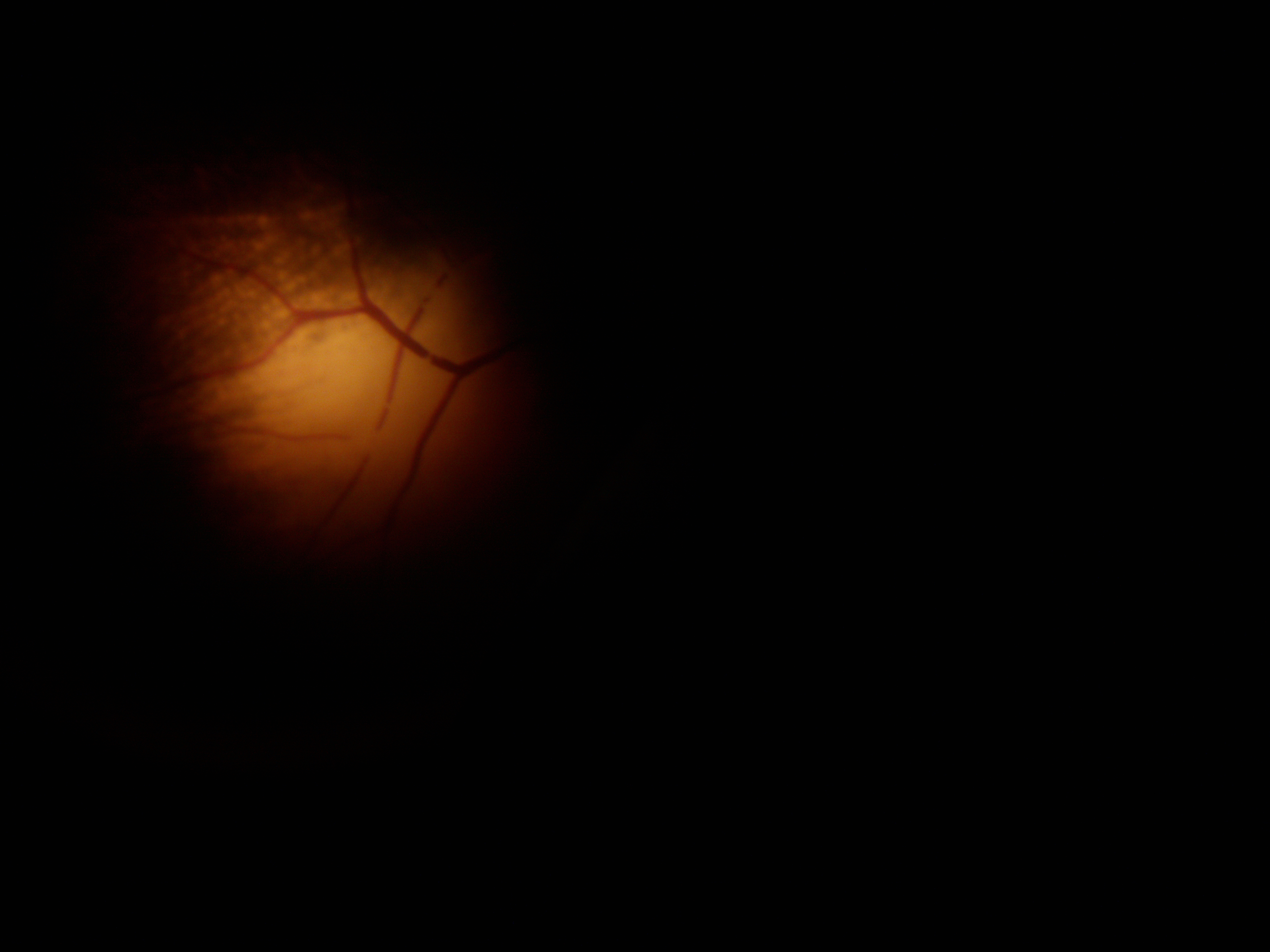 Artificial Eye View