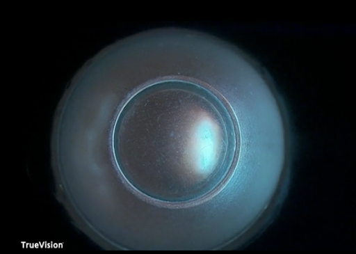 Artificial Eye View